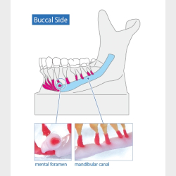 Mandibular Nervemodel
